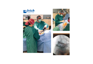© ulrich medical. All rights reserved. Use, reproduction or transfer without express authorization is not permitted. © ulrich medical. All rights reserved. Use, reproduction or transfer without express authorization is not permitted.