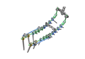 © ulrich medical. All rights reserved. Use, reproduction or transfer without express authorization is not permitted. © ulrich medical. All rights reserved. Use, reproduction or transfer without express authorization is not permitted.
